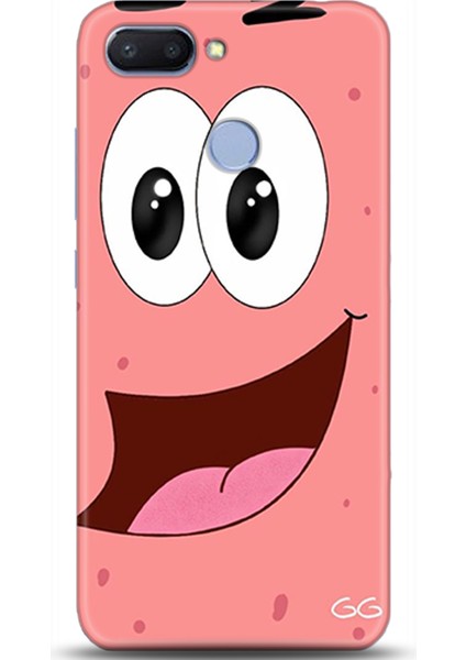 Xiaomi Redmi 6 Kılıf Hd Baskılı Kılıf - Followed Institution 0027