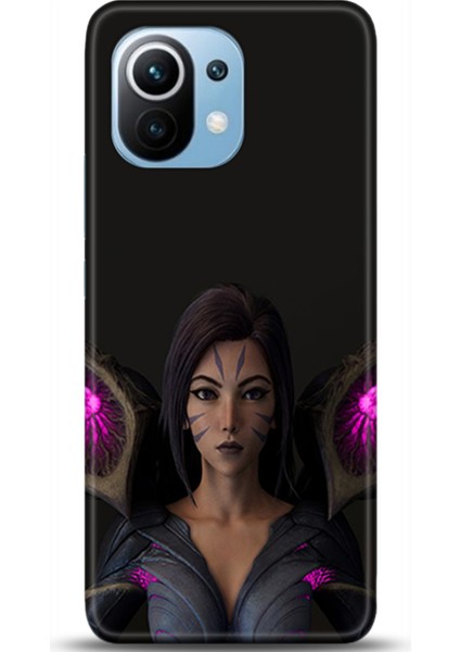 Xiaomi Mi 11 Kılıf Hd Baskılı Kılıf - Followed Institution 0108
