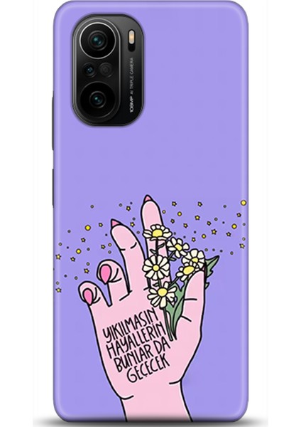 Xiaomi Mi 11i Kılıf Hd Baskılı Kılıf - Followed Institution 0427
