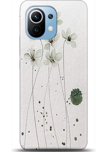 Xiaomi Mi 11 Kılıf Hd Baskılı Kılıf - Followed Institution 0343