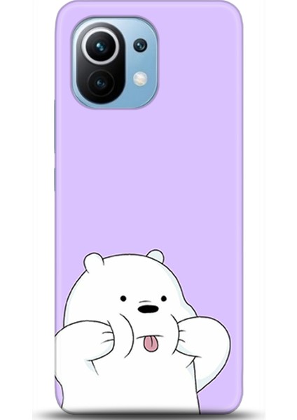 Xiaomi Mi 11 Kılıf Hd Baskılı Kılıf - Followed Institution 0436