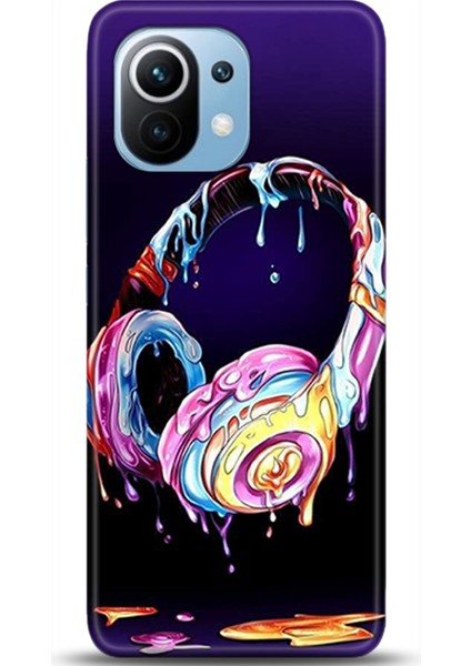 Xiaomi Mi 11 Kılıf Hd Baskılı Kılıf - Followed Institution 0454