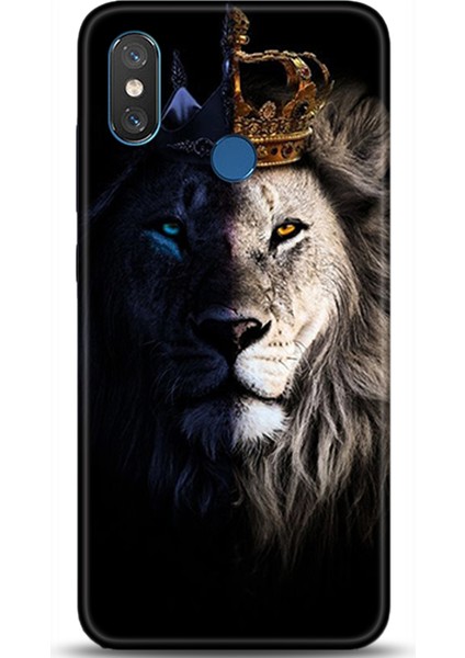 Xiaomi Mi 8 Kılıf Hd Baskılı Kılıf - Followed Institution 0534