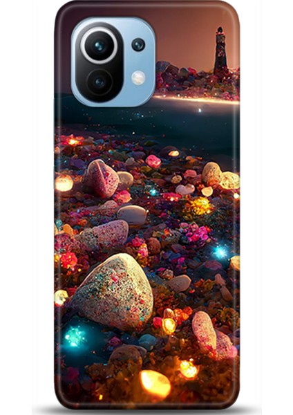 Xiaomi Mi 11 Kılıf Hd Baskılı Kılıf - Followed Institution 0640