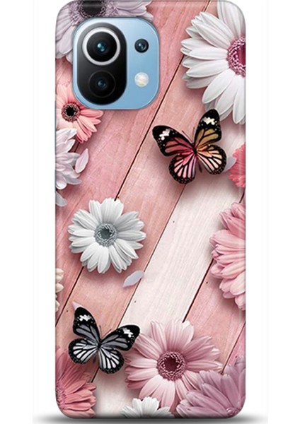 Xiaomi Mi 11 Kılıf Hd Baskılı Kılıf - Followed Institution 0641