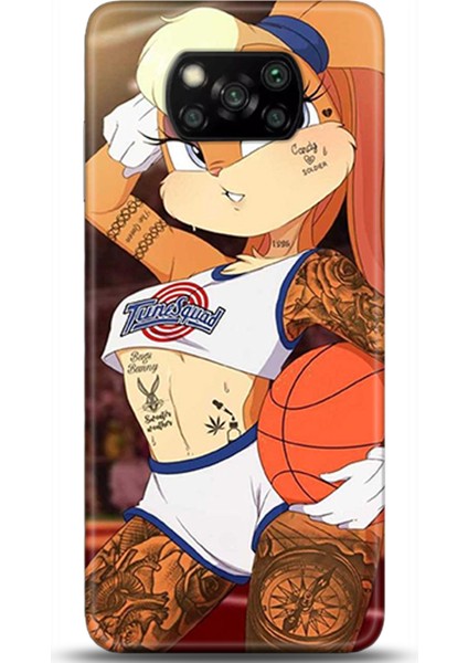 Xiaomi Poco X3 Pro Kılıf Hd Baskılı Kılıf - Followed Institution 0021