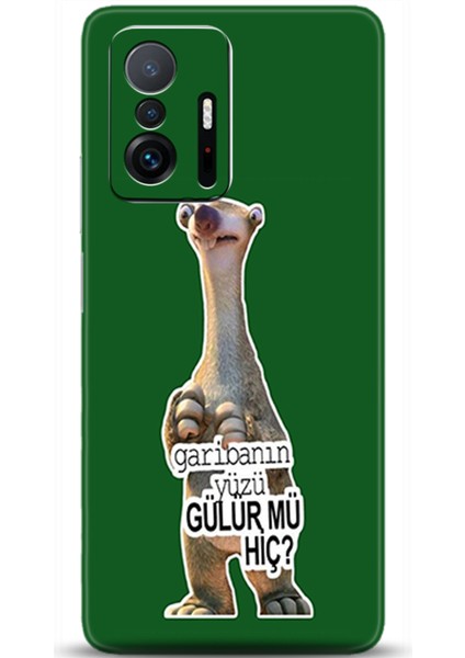 Xiaomi Mi 11T Kılıf Hd Baskılı Kılıf - Followed Institution 0004