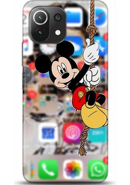 Xiaomi Mi 11 Lite Kılıf Hd Baskılı Kılıf - Followed Institution 0663