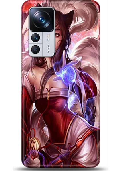 Xiaomi Mi 12T Kılıf Hd Baskılı Kılıf - Followed Institution 0190
