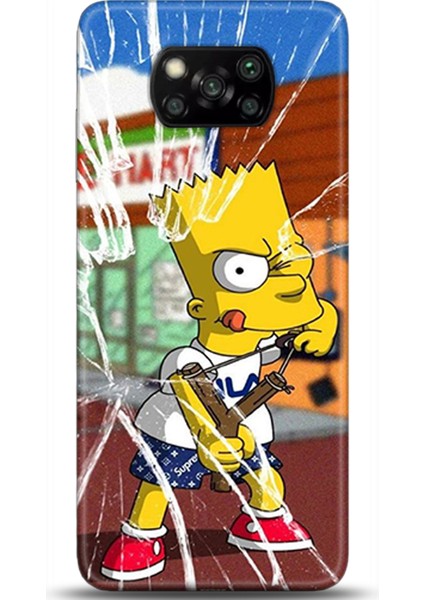 Xiaomi Poco X3 Pro Kılıf Hd Baskılı Kılıf - Followed Institution 0279