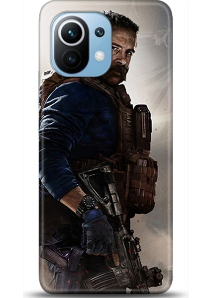 Xiaomi Mi 11 Kılıf Hd Baskılı Kılıf - Followed Institution 0143