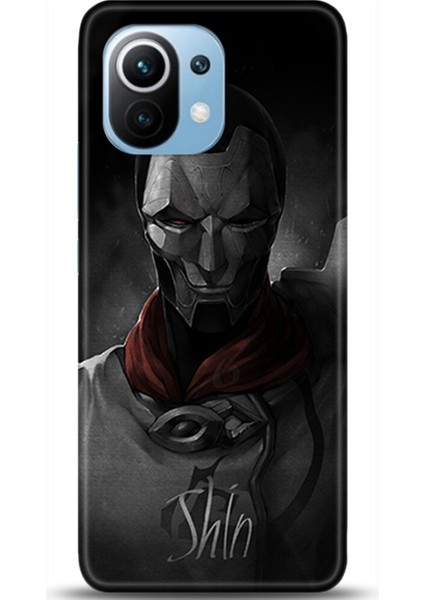Xiaomi Mi 11 Kılıf Hd Baskılı Kılıf - Followed Institution 0167