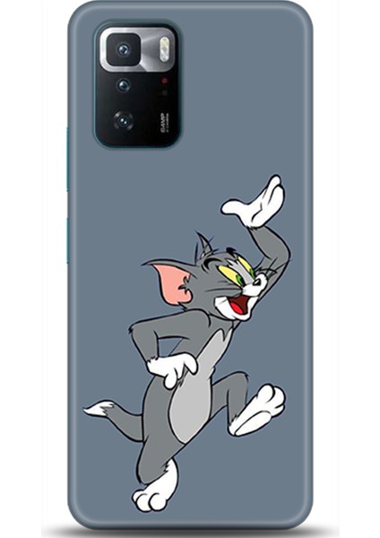 Xiaomi Poco X3 Gt Kılıf Hd Baskılı Kılıf - Followed Institution 0281