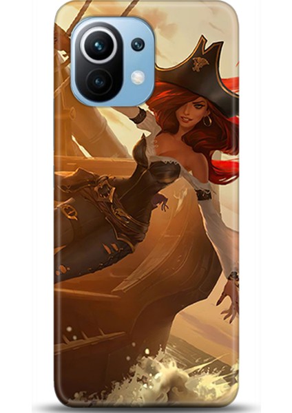 Xiaomi Mi 11 Kılıf Hd Baskılı Kılıf - Followed Institution 0255
