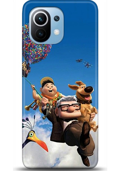 Xiaomi Mi 11 Kılıf Hd Baskılı Kılıf - Followed Institution 0451