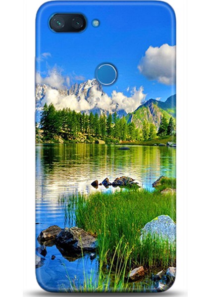 Xiaomi Mi 8 Lite Kılıf Hd Baskılı Kılıf - Followed Institution 0133
