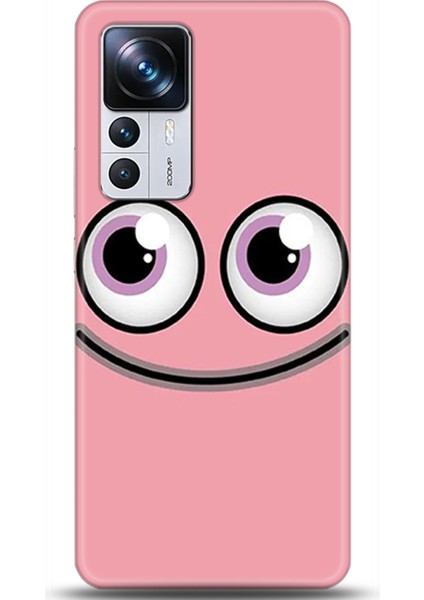 Xiaomi Mi 12T Kılıf Hd Baskılı Kılıf - Followed Institution 0066