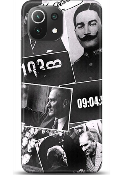 Xiaomi Mi 11 Lite Kılıf Hd Baskılı Kılıf - Followed Institution 0051