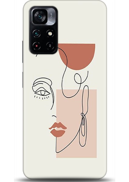 Xiaomi Poco M4 Pro 5g Kılıf Hd Baskılı Kılıf - Followed Institution 0172