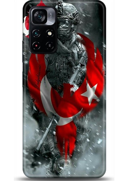 Xiaomi Poco M4 Pro 5g Kılıf Hd Baskılı Kılıf - Followed Institution 0231