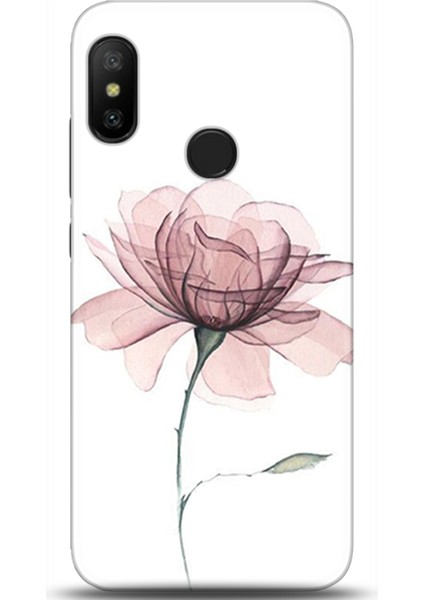 Xiaomi Mi A2 Lite Kılıf Hd Baskılı Kılıf - Followed Institution 0309