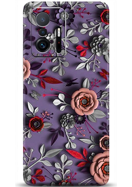 Xiaomi Mi 11T Kılıf Hd Baskılı Kılıf - Followed Institution 0653