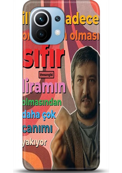 Xiaomi Mi 11 Kılıf Hd Baskılı Kılıf - Followed Institution 0078