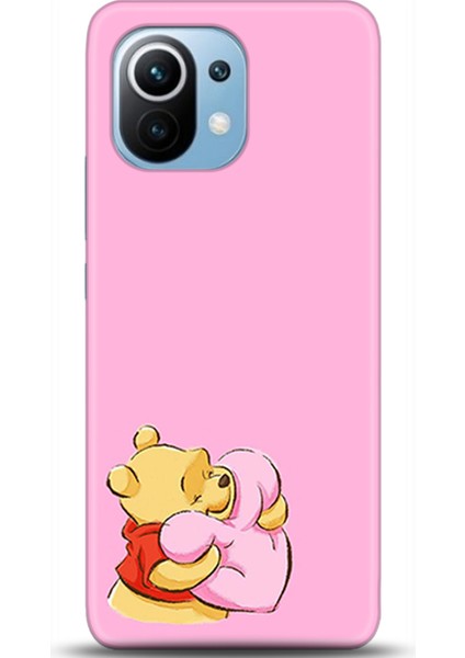 Xiaomi Mi 11 Kılıf Hd Baskılı Kılıf - Followed Institution 0462