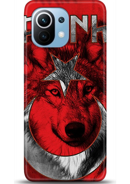 Xiaomi Mi 11 Kılıf Hd Baskılı Kılıf - Followed Institution 0470