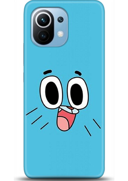 Xiaomi Mi 11 Kılıf Hd Baskılı Kılıf - Followed Institution 0569