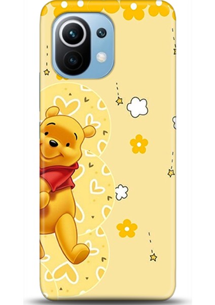 Xiaomi Mi 11 Kılıf Hd Baskılı Kılıf - Followed Institution 0609
