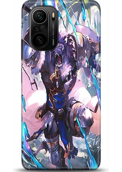 Xiaomi Mi 11i Kılıf Hd Baskılı Kılıf - Followed Institution 0160