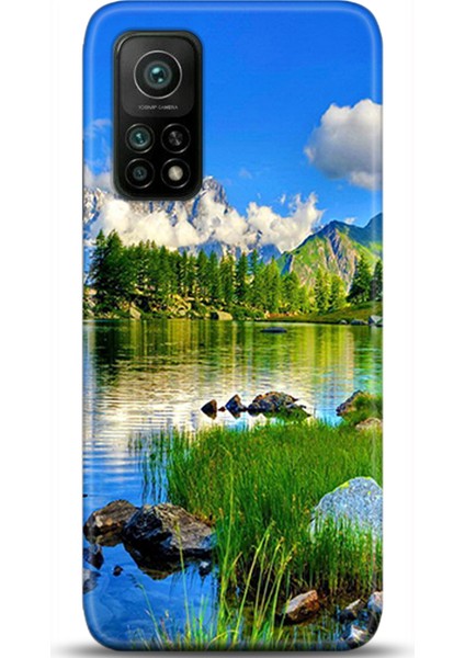 Xiaomi Mi 10T Pro Kılıf Hd Baskılı Kılıf - Followed Institution 0133