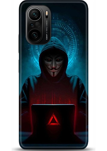 Xiaomi Mi 11i Kılıf Hd Baskılı Kılıf - Followed Institution 0378