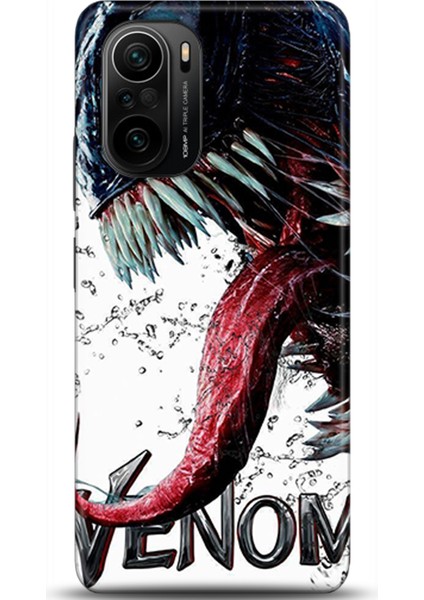 Xiaomi Poco F3 Kılıf Hd Baskılı Kılıf - Followed Institution 0568