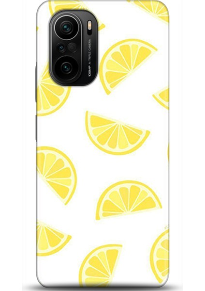 Xiaomi Poco F3 Kılıf Hd Baskılı Kılıf - Followed Institution 0105