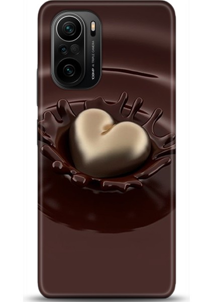 Xiaomi Mi 11i Kılıf Hd Baskılı Kılıf - Followed Institution 0699