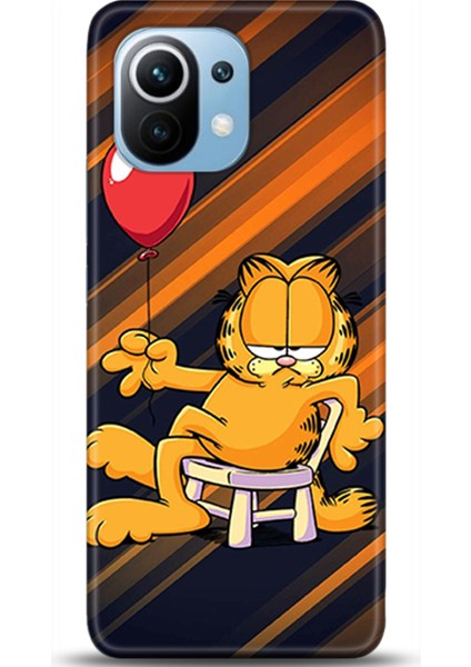 Xiaomi Mi 11 Kılıf Hd Baskılı Kılıf - Followed Institution 0155