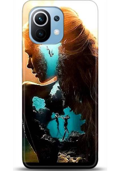 Xiaomi Mi 11 Kılıf Hd Baskılı Kılıf - Followed Institution 0377