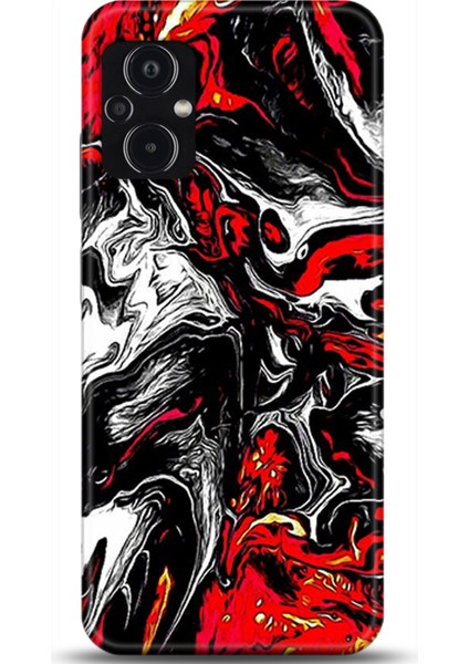 Xiaomi Poco M5 Kılıf Hd Baskılı Kılıf - Followed Institution 0531