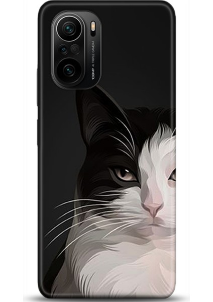 Xiaomi Mi 11i Kılıf Hd Baskılı Kılıf - Followed Institution 0555