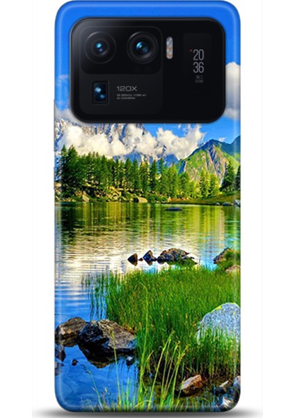 Xiaomi Mi 11 Ultra Kılıf Hd Baskılı Kılıf - Followed Institution 0133