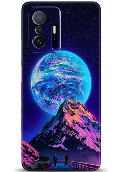 Xiaomi Mi 11T Kılıf Hd Baskılı Kılıf - Followed Institution 0052