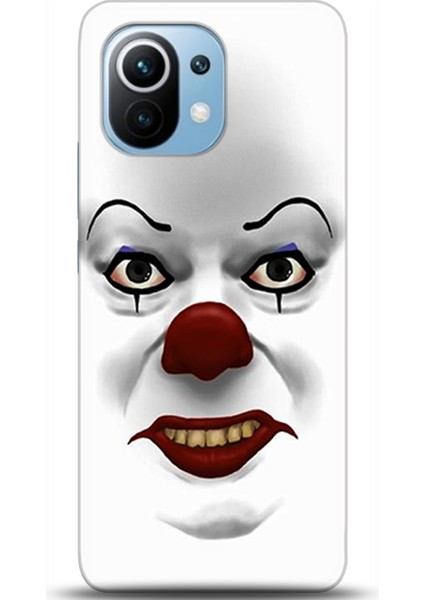 Xiaomi Mi 11 Kılıf Hd Baskılı Kılıf - Followed Institution 0621