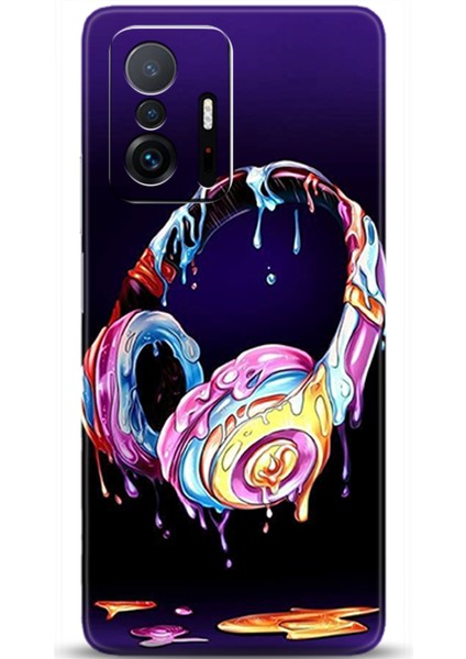 Xiaomi Mi 11T Kılıf Hd Baskılı Kılıf - Followed Institution 0454