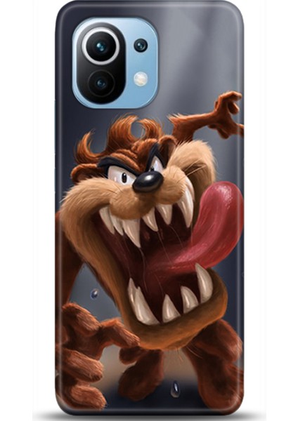 Xiaomi Mi 11 Kılıf Hd Baskılı Kılıf - Followed Institution 0214
