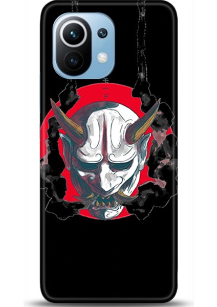 Xiaomi Mi 11 Kılıf Hd Baskılı Kılıf - Followed Institution 0238