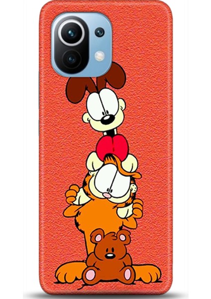 Xiaomi Mi 11 Kılıf Hd Baskılı Kılıf - Followed Institution 0401