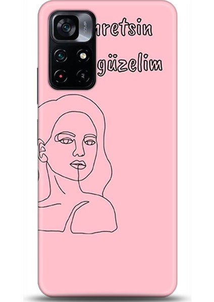 Xiaomi Poco M4 Pro 5g Kılıf Hd Baskılı Kılıf - Followed Institution 0074