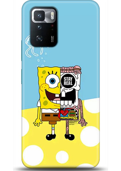 Xiaomi Poco X3 Gt Kılıf Hd Baskılı Kılıf - Followed Institution 0623